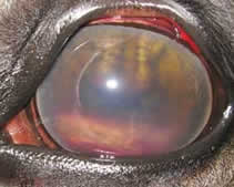 akute Uveitis 